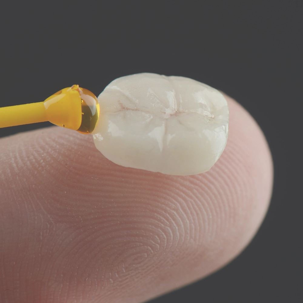 Dentist discussing a dental model with a patient, focusing on a colorful dental implant model, illustrating a personalized consultation.