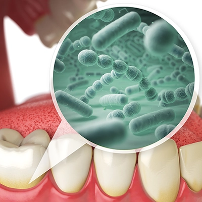 Microscopic view of bacteria on teeth, highlighting the need for proper dental hygiene to prevent plaque buildup.