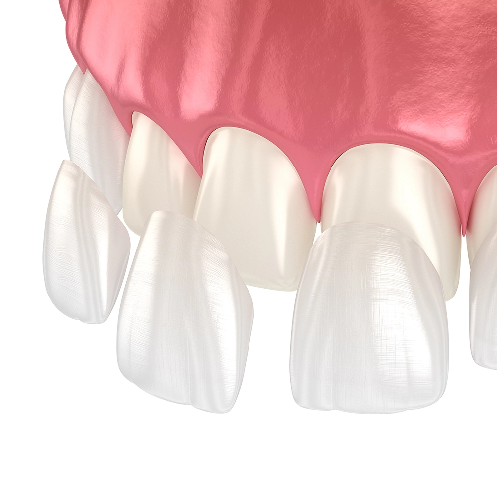 Detailed 3D rendering of the upper section of human teeth and gums, showcasing the smooth enamel of the teeth and the healthy pink gums.