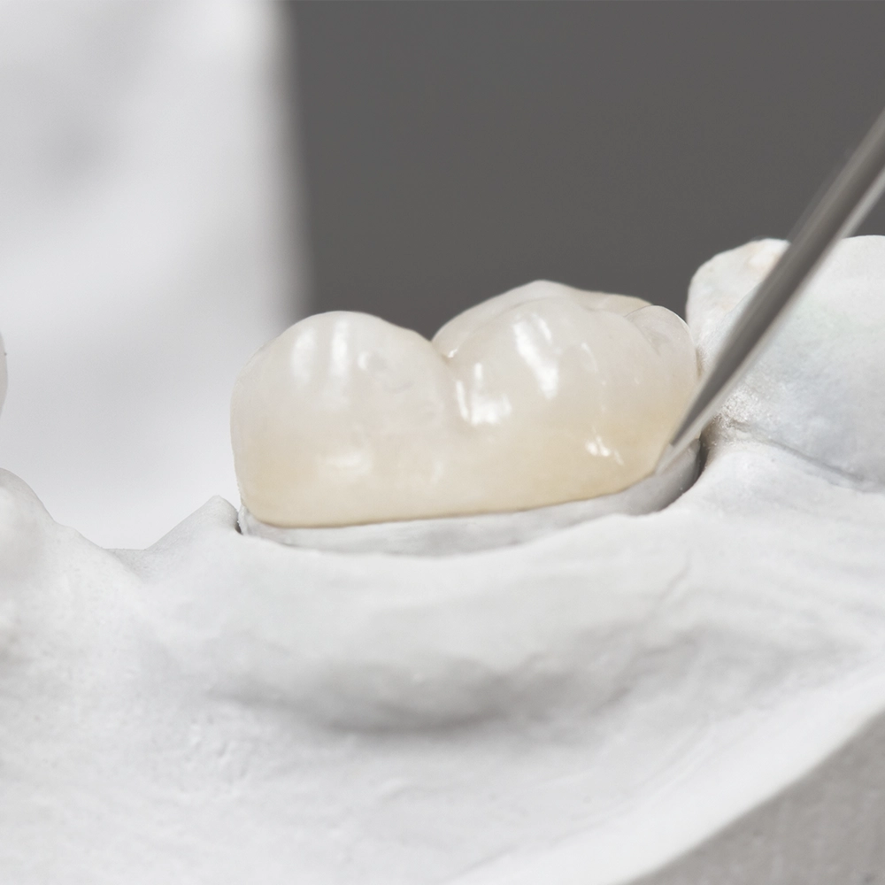 Close-up of a dental procedure involving a mouth guard, showing a detailed view of the dental work in progress with water spray visible.