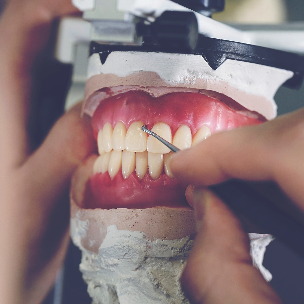 A dental technician's hands meticulously adjust dentures on a detailed dental model, illustrating the precise work involved in fitting and refining dentures for optimal function.